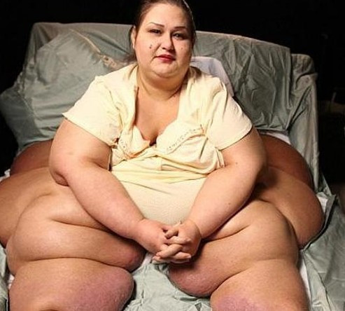 Onu birde şimdi görün! Vücudunun yüzde 80'i gitti - Resim: 1