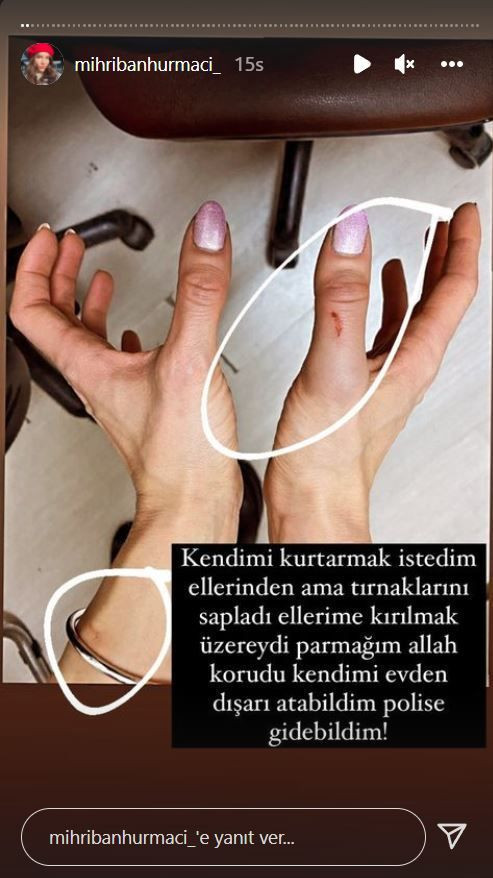 Özer Hurmacı Mihriban Hurmacı şiddet olayı ne ünlü futbolcudan son açıklama Mihriban Dinçer Hurmacı kimdir - Resim: 3