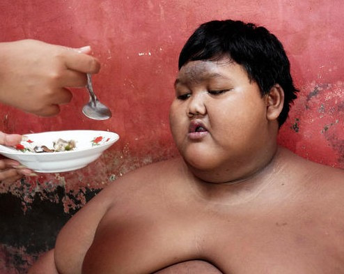 Günde 5 öğün pilav yiyerek bu hale geldi! Şuna bakın... - Resim: 2