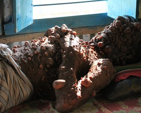 Görenler ona canavar diyor eğer tedavi edilmezse... - Resim: 2