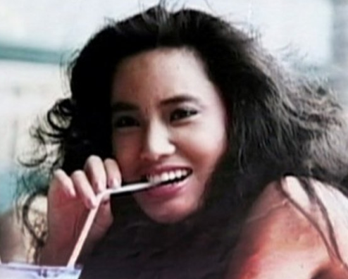 Yüzüne yemeklik yağ enjekte edince...  - Resim: 2