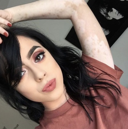 Görenler hayrete düşüyor! Hastalığını sanata çevirdi - Resim: 2