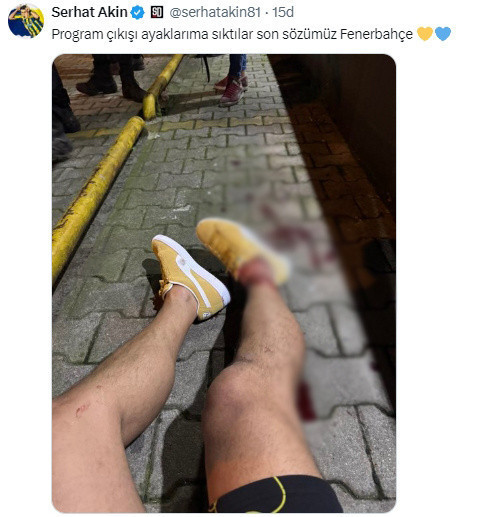 Eski Fenerbahçeli futbolcu Serhat Akın'a silahlı saldırı - Resim: 0