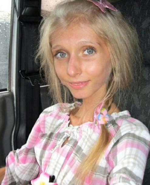 Zayıflık takıntısı bu hale getirdi - Resim: 4