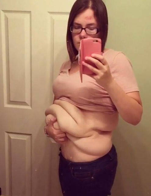 64 kilo verdi ama görenler inanmıyor bakın neden - Resim: 2