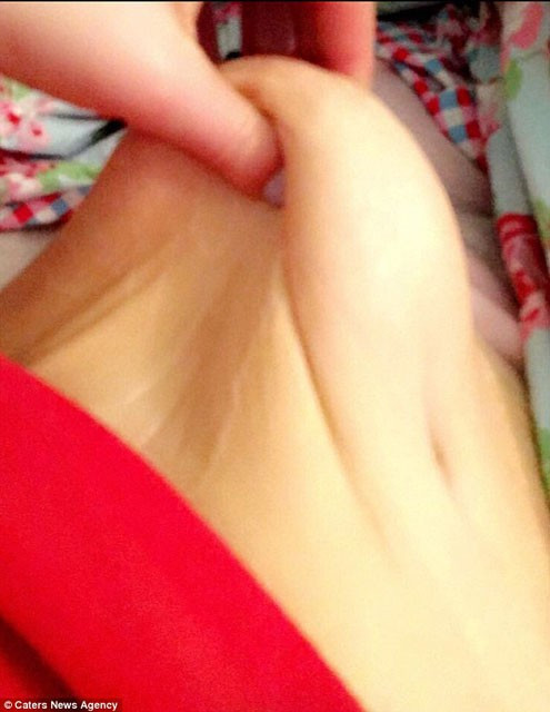 Vücudundan 3 kilo deriyi kesip attırdı - Resim: 3