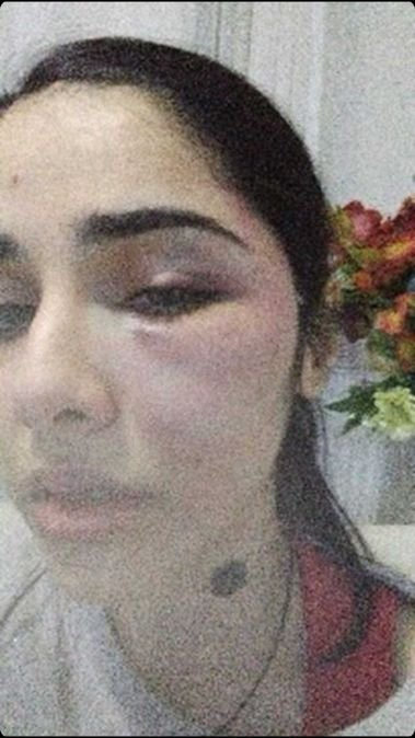 İstanbul'da boşanma aşamasındaki eşi dehşeti yaşattı! "Gözlerimi kapatıp şehadet getirdim" - Resim: 0