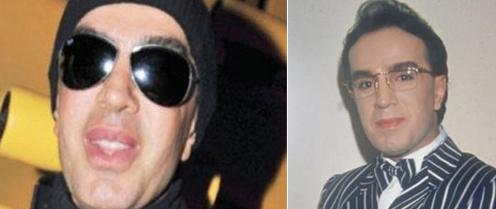 İşte estetik yaptıran ünlü erkekler! - Resim: 2