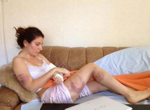 Twitter'dan dayak fotoğraflarını paylaştı - Resim: 1