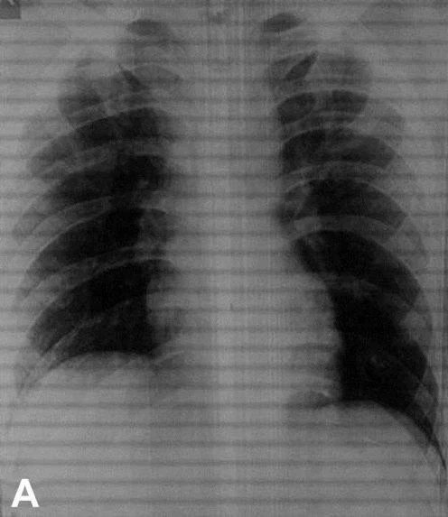 'Duşta kayıp üzerine düştüm' dedi doktorlar görünce gözlerine inanamadı - Resim: 4