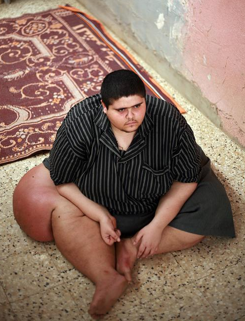 400 kilo olan genç yardım bekliyor - Resim: 1