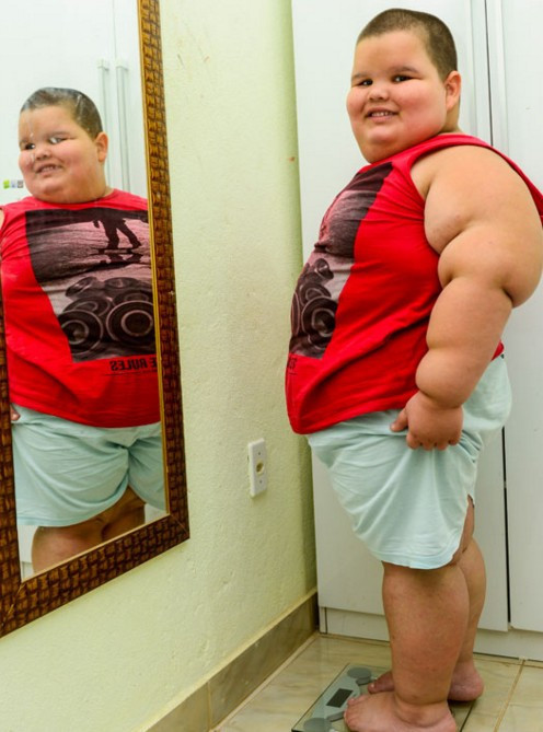 Sadece 5 yaşında... Tedavi edilmezse ölecek - Resim: 2