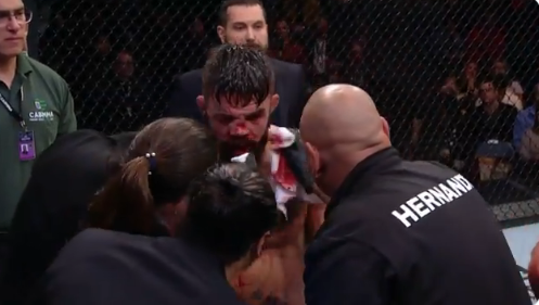 Mike Perry'nin burnu kırıldı suratı tanınmaz hale geldi - Resim: 4