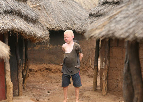 Öldürüp bedenlerini satıyorlar - Resim: 1