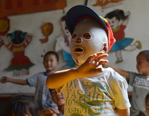 Zavallı çocuğun başına gelene bakın! - Resim: 1