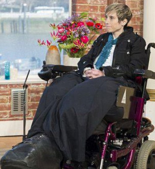 Bu kadının tek bacağı 107 kilo! - Resim: 4