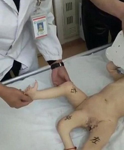 Dünyayı ayağa kaldırdı üç bacaklı çocuk kıyamet alameti gibi - Resim: 2