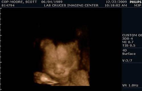 Hamile bir erkek daha! - Resim: 2