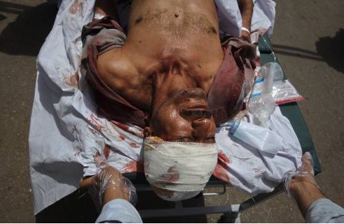 Dünyada işte bunlar tıklandı - Resim: 1