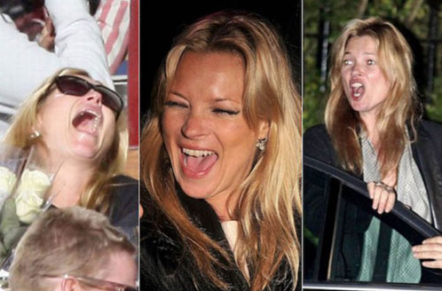 Ağzı açık güzeller - Resim: 3