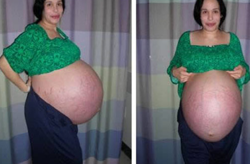 Siz 5 yaşında bir anne gördünüz mü? - Resim: 2