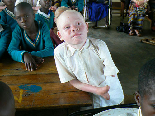 Öldürüp bedenlerini satıyorlar - Resim: 4