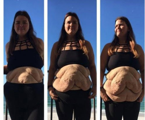 Annesinin bir sözlü ile 100 kilo verdi! - Resim: 3