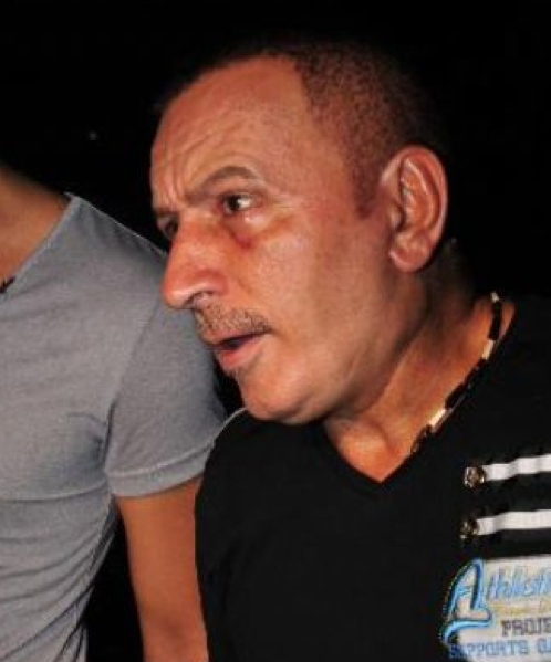 İşte botokslu Mustafa Topaloğlu - Resim: 4