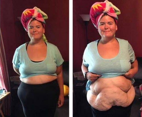 Annesinin bir sözlü ile 100 kilo verdi! - Resim: 1