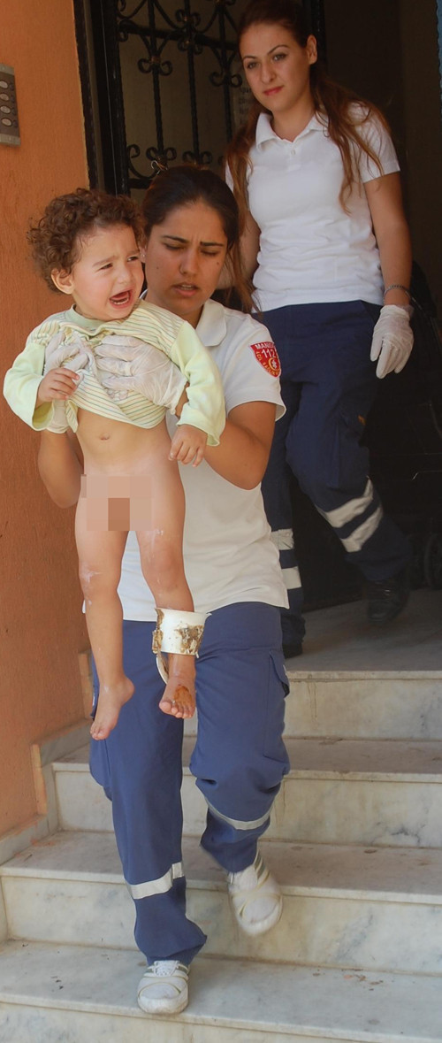 Ayağını tuvalate kaptırdı - Resim: 2