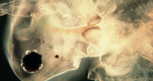 Bir damla suyun içindekiler - Resim: 3