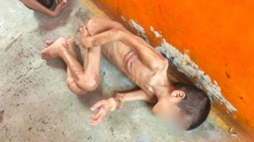 Çocukları kafese kapattılar - Resim: 4