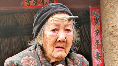 Bu kadının alnında boynuzları var - Resim: 3