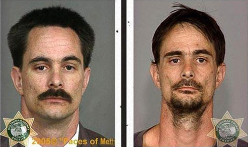 Uyuşturucunun erittiği bedenler - Resim: 4