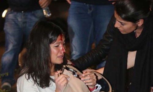 TOMA, 2 eylemciye çarptı! - Resim: 3