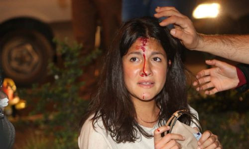 TOMA, 2 eylemciye çarptı! - Resim: 4