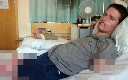 Soğuk algınlığı zannettiği hastalık hayatını kararttı - Resim: 1