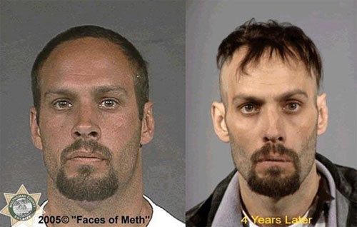 Uyuşturucunun erittiği bedenler - Resim: 2