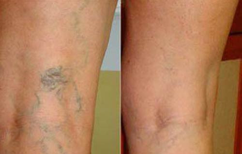 Modern çağın hastalıkları - Resim: 4