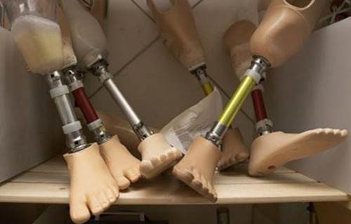 Unutulan garip eşyalar - Resim: 1