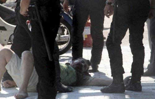 Kredilerini ödeyemeyince kendini yaktı - Resim: 1