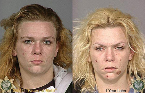 Uyuşturucunun erittiği bedenler - Resim: 3