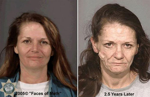 Uyuşturucunun erittiği bedenler - Resim: 1