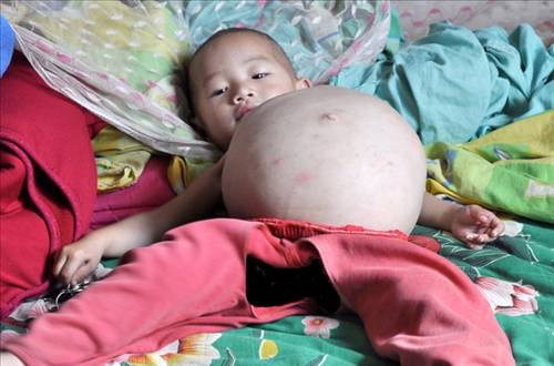 İnanması zor tıbbi vakalar - Resim: 1