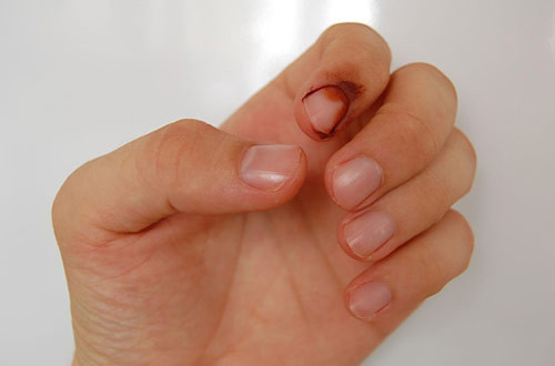 Bugün referandum olursa - Resim: 2