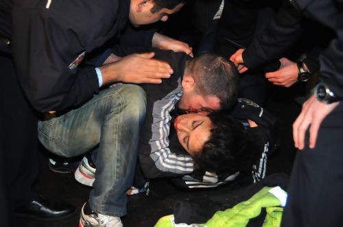 Kanlar içindeki sevgilisine böyle sarıldı! - Resim: 2