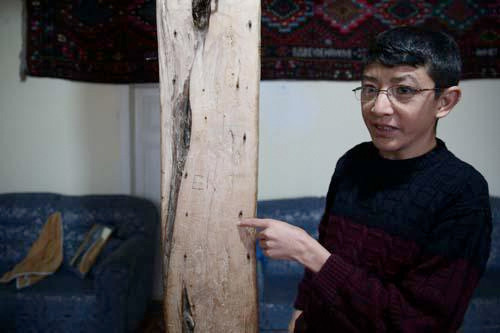 Kayseri'de yaşını duyan inanamıyor! 'Benjamin Button' vakası - Resim: 4