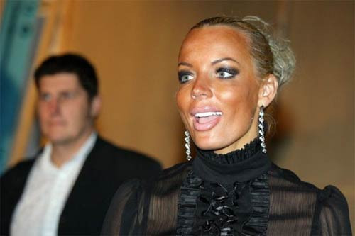 Silikon yaptırınca bu hale geldiler - Resim: 4