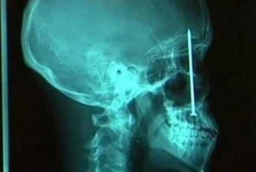 Bu röntgenler çok şaşırtacak  - Resim: 2