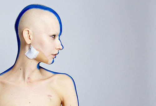 Genç model kanser oldu ama vazgeçmedi - Resim: 4